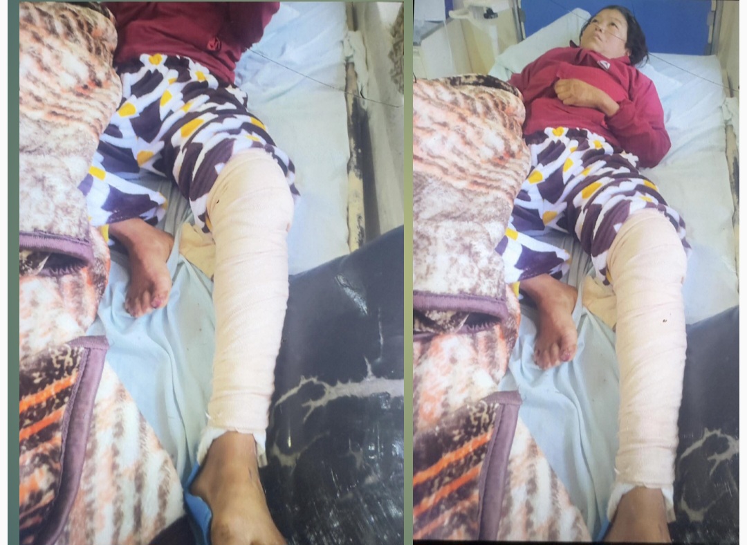 आर्शु स्मृति प्रतिष्ठानद्वारा लक्ष्मी तामाङको निःशुल्क उपचार